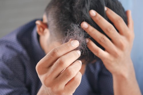 Andropause and Hair Loss